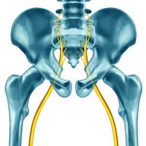 Scoliosis: Can It Trigger Sciatica?